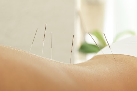 Praxis Karolina Tröber, Praxis für Chinesische Medizin Akupunktur u. Chin. Kräutertherapie und Vitalpilze, Dorn Therapie